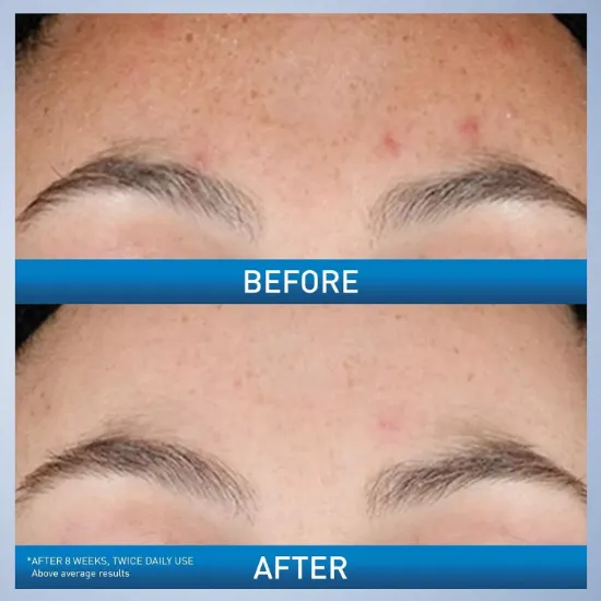 Picture of CERAVE RESURFACING RETINOL SERUM 30ML